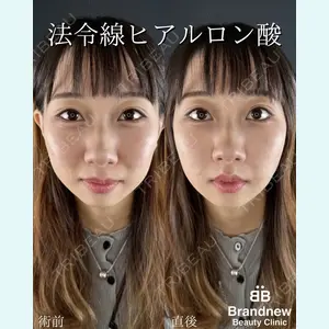 Brandnew Beauty Clinic 平山 容成医師の症例
