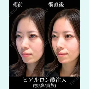 HAAB×DREAM BEAUTY CLINIC 東京本院 佐野 圭医師の症例