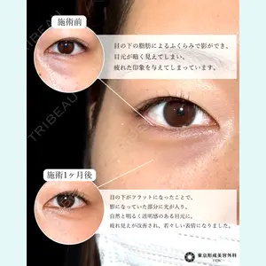 症例