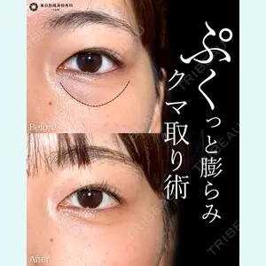 症例