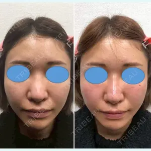 しのぶ皮膚科 蘇原しのぶ医師の症例