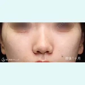 聖心美容クリニック 銀座院 川端 優也医師の症例