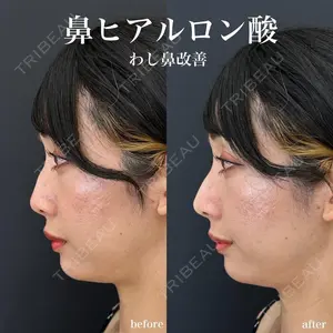 症例