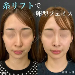 症例