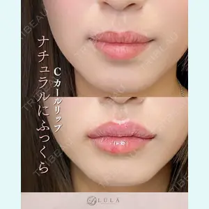 症例
