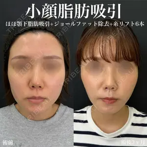 症例