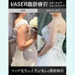 湘南美容クリニック 松戸院 小野聡真医師の症例