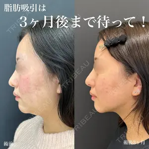 症例