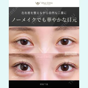 症例