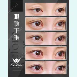 症例