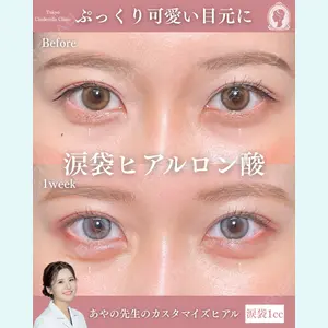 症例