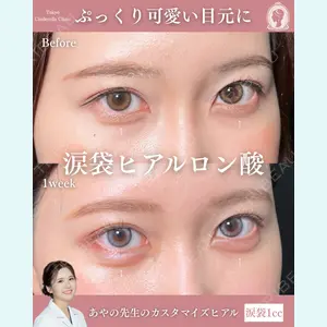 症例