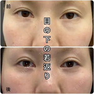 症例