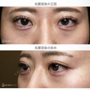 聖心美容クリニック 札幌院 前多 一彦医師の症例