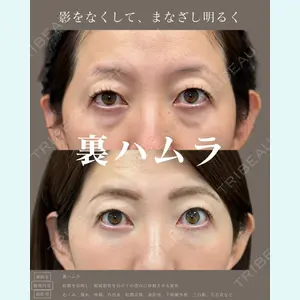 症例
