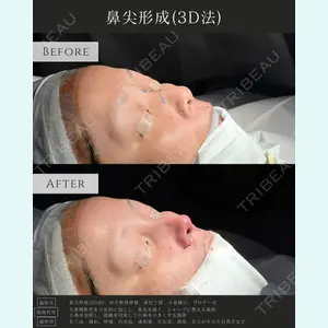 症例