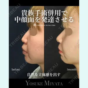 シンデレラ＆ダヴィンチクリニック 宮田 洋佑医師の症例