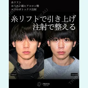 PRISM Beauty Clinicの症例