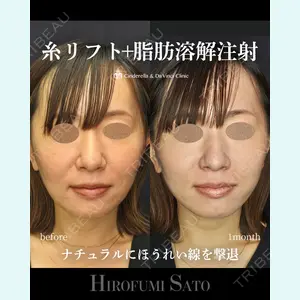 症例