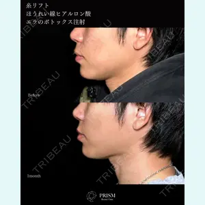PRISM Beauty Clinicの症例