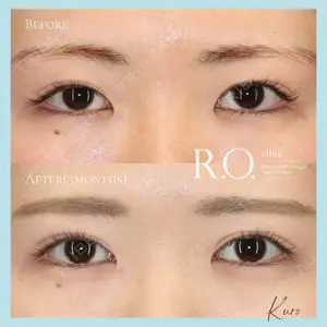 R.O.clinic 黒田 大樹医師の症例