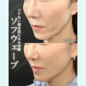 症例