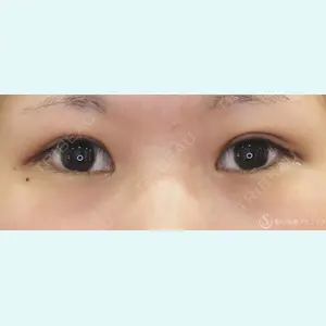 聖心美容クリニック 福岡院 美原 寿之医師の症例