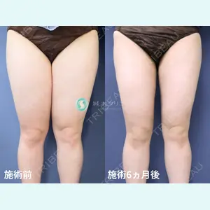 症例