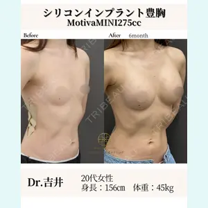 症例