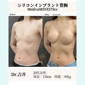 お茶の水美容形成クリニック 吉井 健吾医師の症例