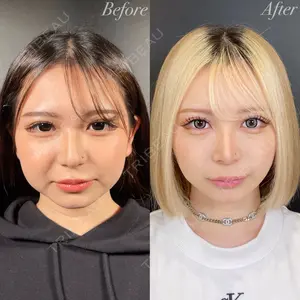 症例
