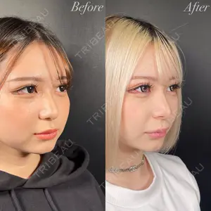 症例