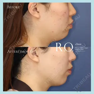 R.O.clinic 黒田 大樹医師の症例