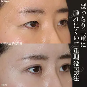 大塚美容形成外科 札幌院の症例