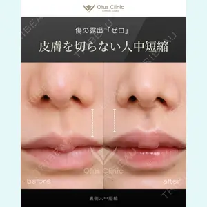 症例