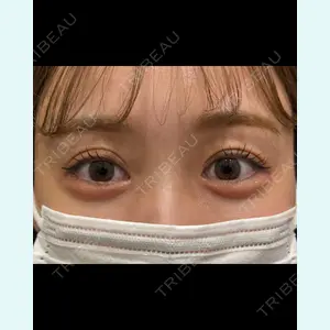 症例
