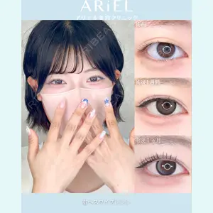 症例