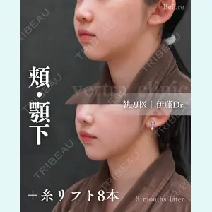 ヴェルトラクリニック 新宿院 伊藤　優医師の症例