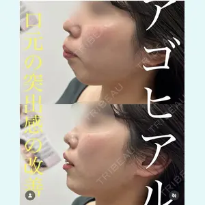 症例