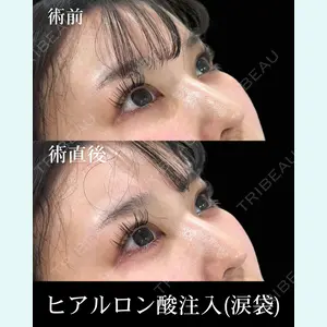 HAAB×DREAM BEAUTY CLINIC 東京本院 佐野 圭医師の症例