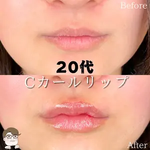 症例