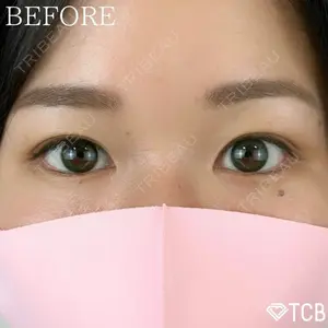 TCB東京中央美容外科 新宿東口院 高柳 佑衣子医師の症例