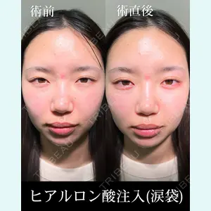 HAAB×DREAM BEAUTY CLINIC 大阪梅田院 柏木 太雅医師の症例