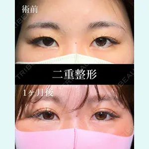 HAAB×DREAM BEAUTY CLINIC 大阪梅田院 柏木 太雅医師の症例