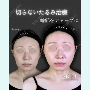 アリエル美容クリニック 郡山院 安齋 誠基医師の症例