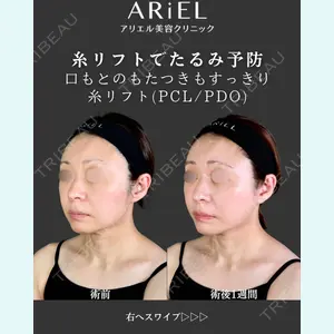 アリエル美容クリニック 郡山院 安齋 誠基医師の症例