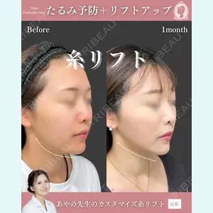 症例
