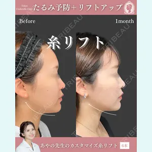 症例