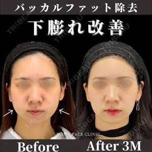 症例