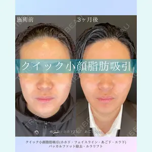 症例